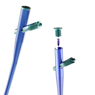 Clavos Intramedulares